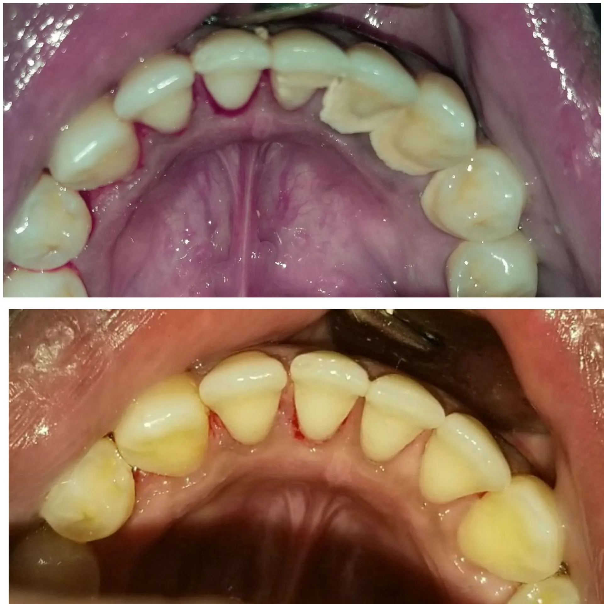 WOW Dental before and after result