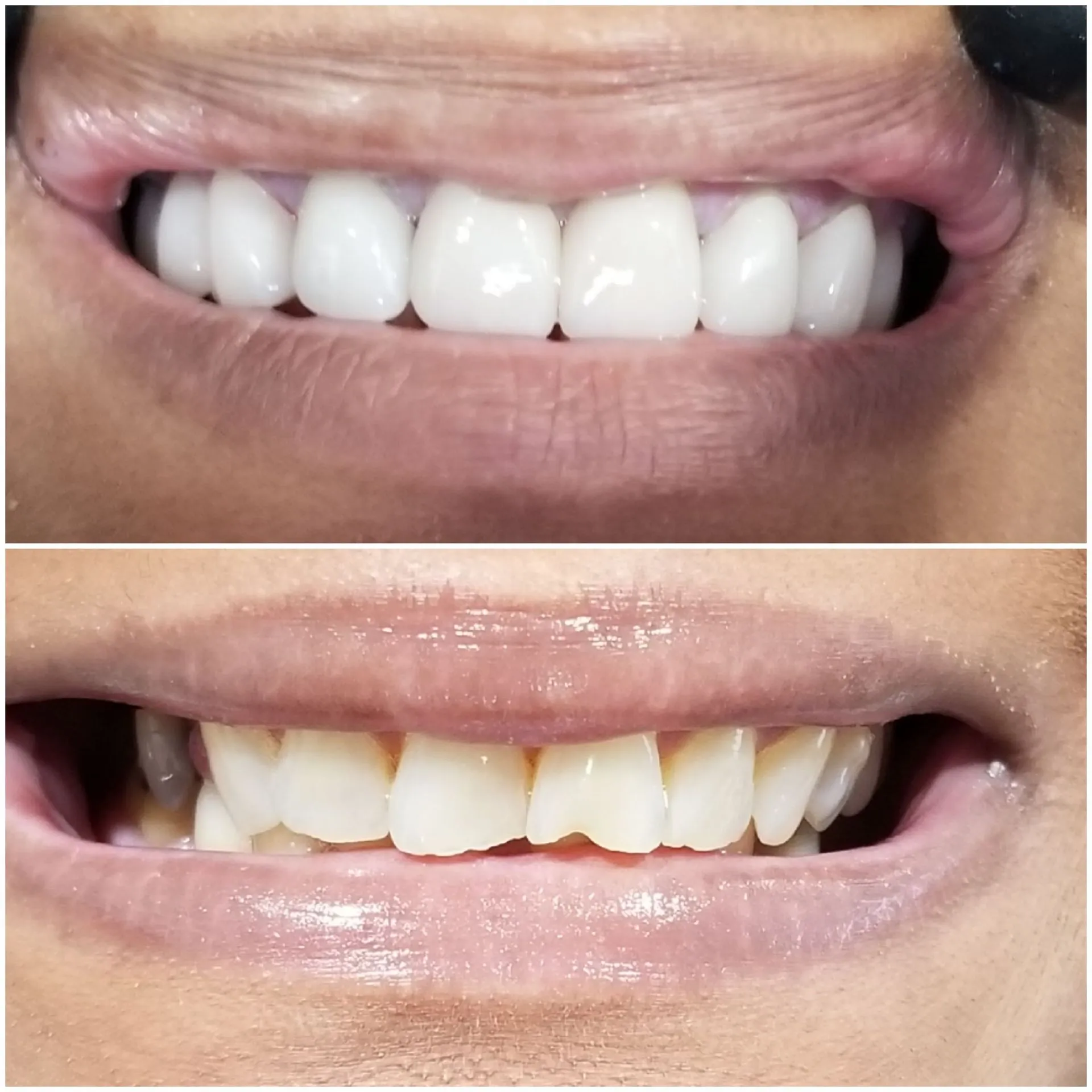 WOW Dental before and after result