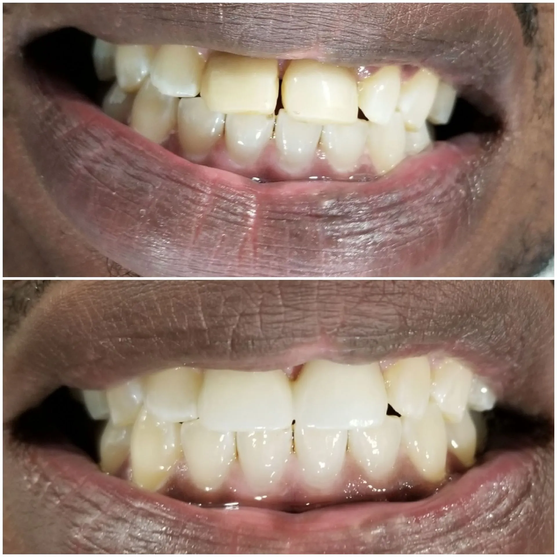 WOW Dental before and after result