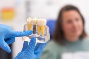Wow Dental | Dental Implants vs. Dentures: Which is Right for You?