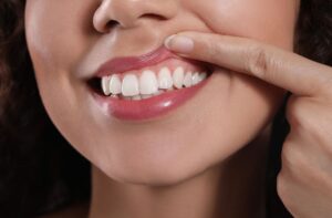 Wow Dental | Keeping Teeth and Gums Healthy: What You Should Eat