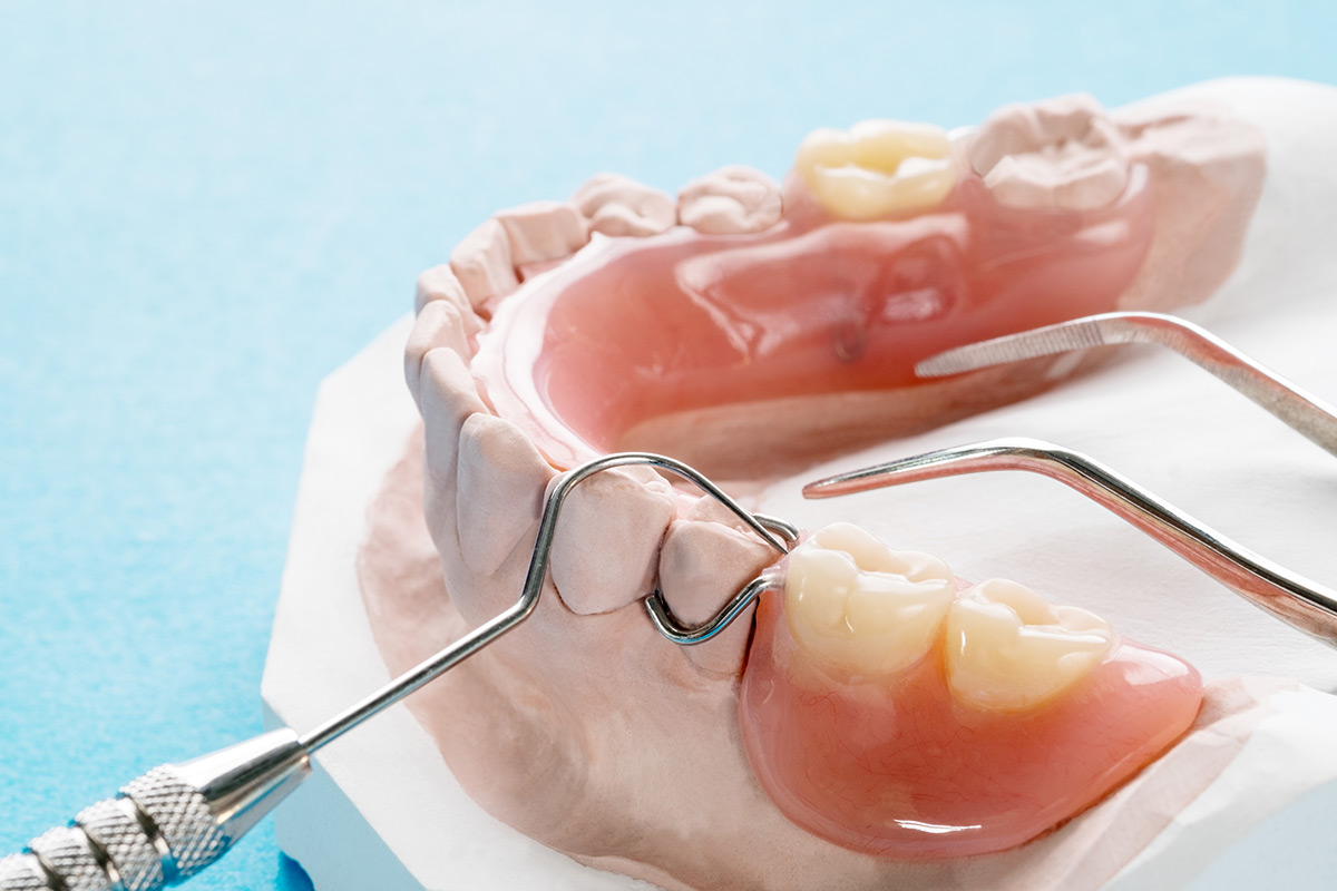 Wow Dental|Dentures