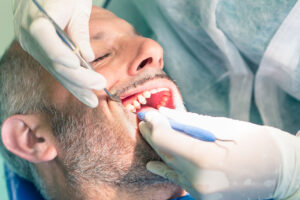 Wow Dental | Root Canal Treatments in Detroit, Saving Teeth and Stopping Pain with Modern Care