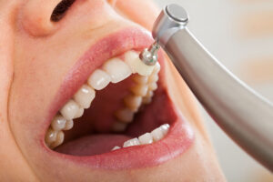 Wow Dental | Routine Dental Cleanings in Detroit, Small Visits That Make a Big Difference Wow Dental | Routine Dental Cleanings in Detroit, Small Visits That Make a Big Difference