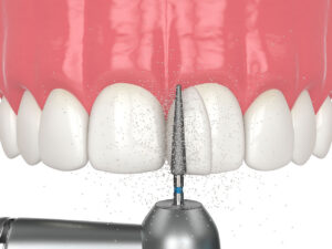 Dental care image at WOW Dental