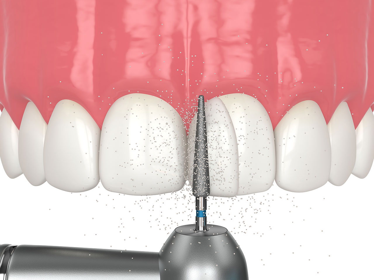 Dental care image at WOW Dental