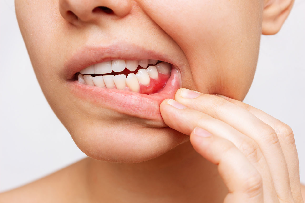 Gum Disease Treatment In Detroit Protecting The Foundation Of A Healthy Smile