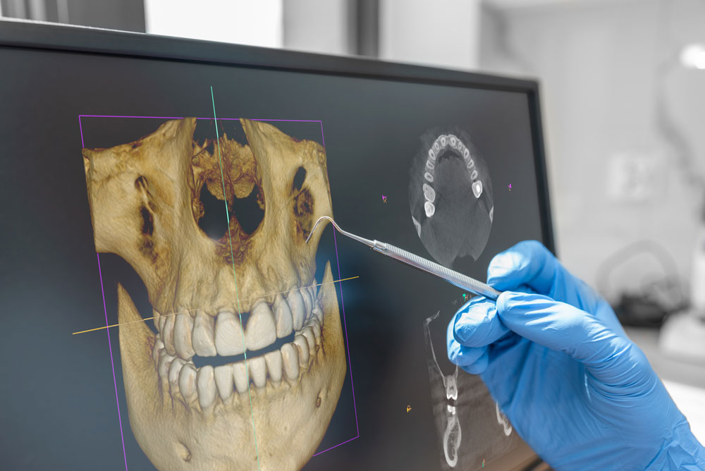Wow Dental | CBCT 3D Imaging for Dental Implants in Detroit, How Better Planning Supports Better Treatment