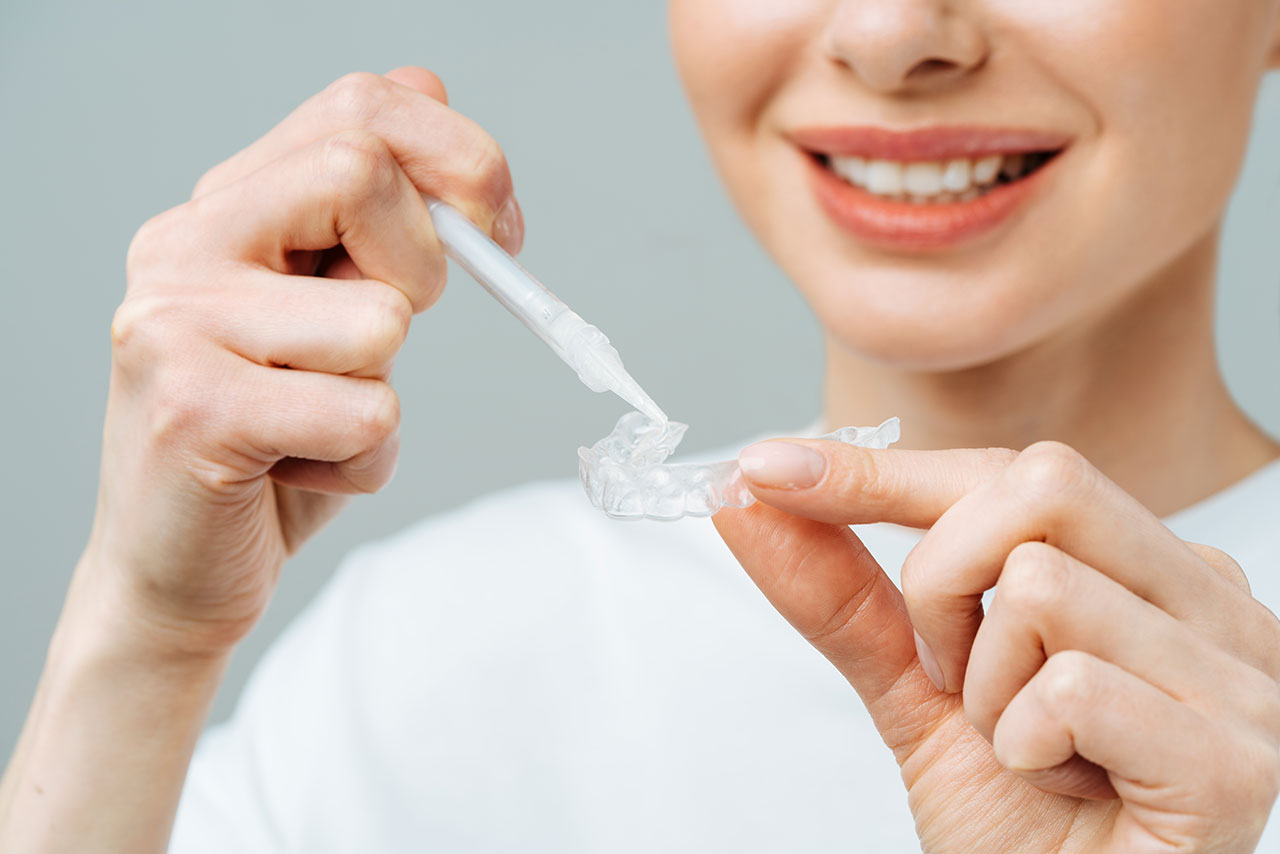 Wow Dental | Fluoride Treatments in Detroit, A Simple Way to Strengthen Teeth Against Cavities